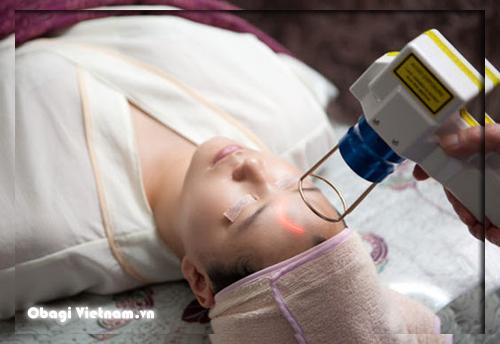 Điều trị bằng laser không cho hiệu quả lâu dài