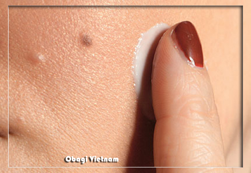 Kem trị mụn Obagi Việt Nam