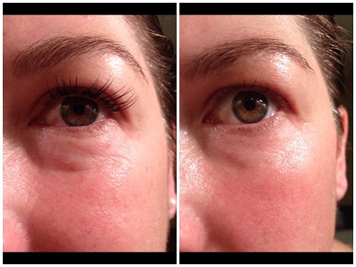 Kết quả sử dụng Obagi Elastiderm Eye Serum