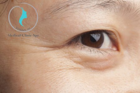 Serum dưỡng sáng da mắt chống nhăn