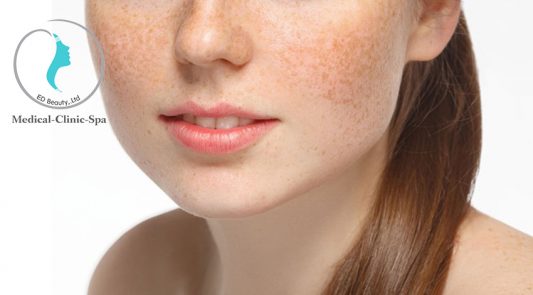 Dùng Kem trị nám chuyên sâu giúp tâm lý thoải, tự tin