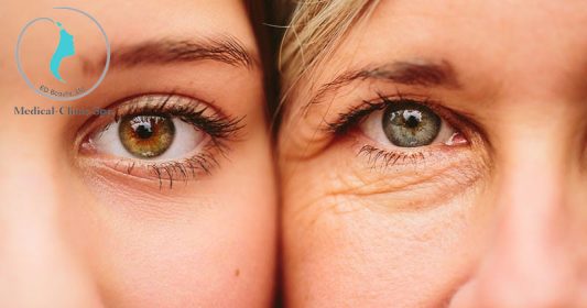Sử dụng kem dưỡng chống nhăn vùng mắt OBAGI