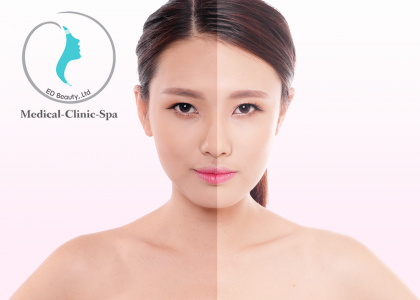 Hãy chọn serum dưỡng trắng OBAGI CLINICAL Vitamin C nếu bạn muốn trắng tự nhiên