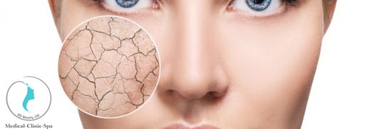 Phục hồi làn da tổn thương do ánh nắng Obagi