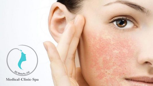 Chọn Obagi Gentle Rejuvenation để trẻ hóa da nhạy cảm