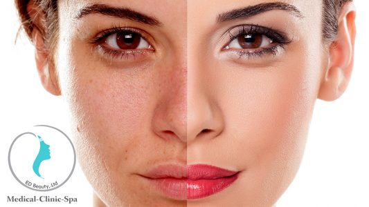 Kem phục hồi tái tạo da giảm sạm nám