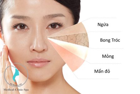 Những lưu ý cần nắm khi chọn kem chống nắng cho da nhạy cảm