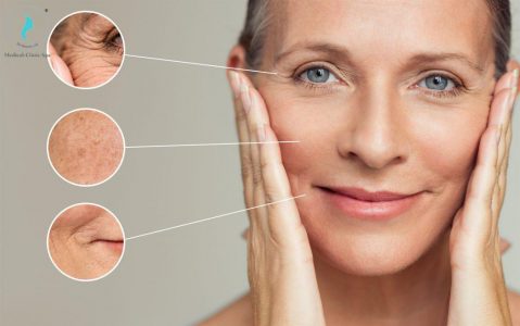 Lựa chọn sản phẩm Obagi cho da có nếp nhăn, chảy xệ