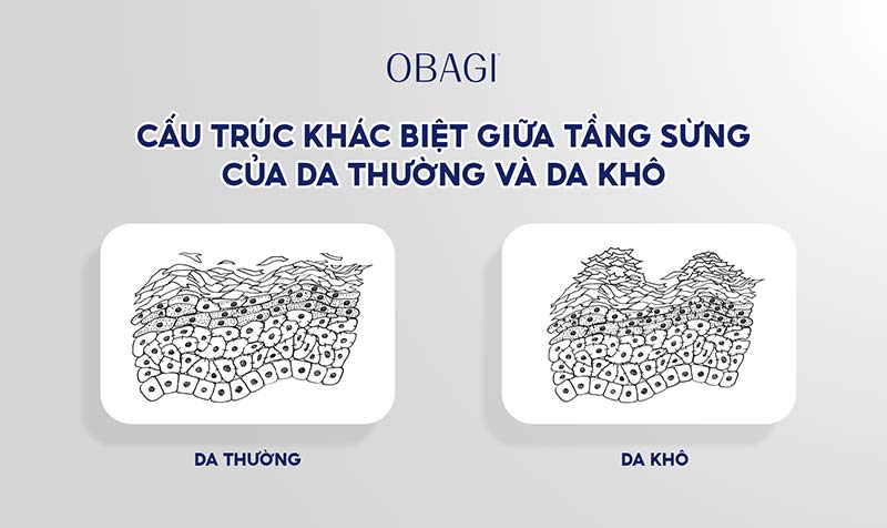 Loại bỏ da chết tầng sừng