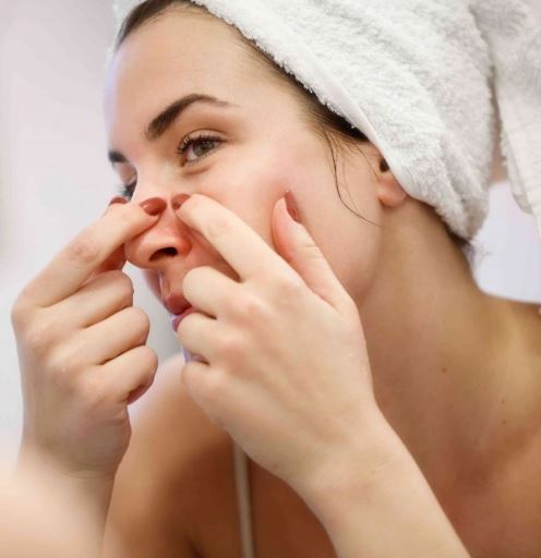 5 loại mụn ở mũi thường gặp