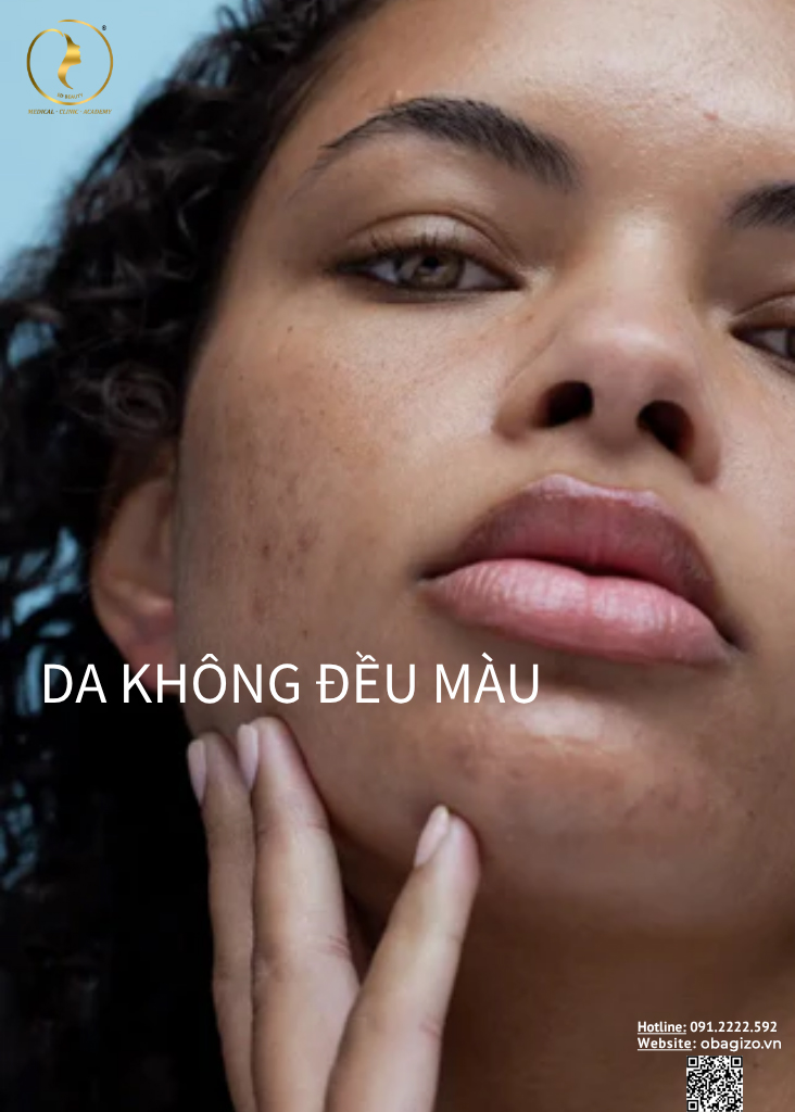 Hình: Da không đều màu ở phụ nữ