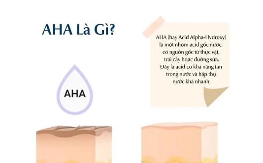 Hình: AHA là gì?
