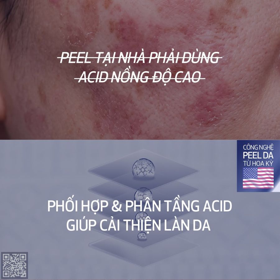 obagi peel pad, cách peel da đúng